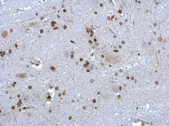 Anti-HMGB1 antibody used in IHC (Paraffin sections) (IHC-P). GTX101277