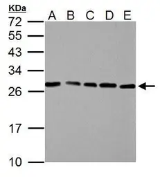 Anti-HMGB1 antibody used in Western Blot (WB). GTX101277