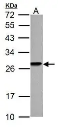 Anti-HMGB1 antibody used in Western Blot (WB). GTX101277