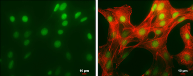 Anti-HMGB1 antibody used in Immunocytochemistry/ Immunofluorescence (ICC/IF). GTX101277