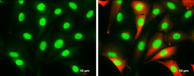 Anti-HMGB1 antibody used in Immunocytochemistry/ Immunofluorescence (ICC/IF). GTX101277