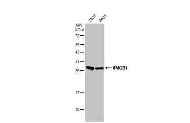 Anti-HMGB1 antibody used in Western Blot (WB). GTX101277