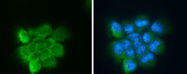 Anti-Apolipoprotein D antibody used in Immunocytochemistry/ Immunofluorescence (ICC/IF). GTX101306