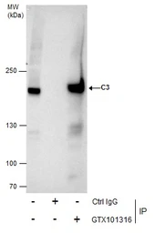 Anti-C3 / C3b antibody [C3], C-term used in Immunoprecipitation (IP). GTX101316