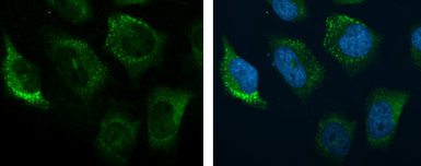 Anti-C3 / C3b antibody [C3], C-term used in Immunocytochemistry/ Immunofluorescence (ICC/IF). GTX101316