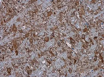 Anti-C3 / C3b antibody [C3], C-term used in IHC (Paraffin sections) (IHC-P). GTX101316