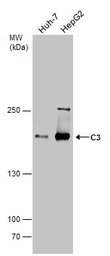 Anti-C3 / C3b antibody [C3], C-term used in Western Blot (WB). GTX101316