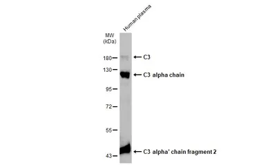 Anti-C3 / C3b antibody [C3], C-term used in Western Blot (WB). GTX101316