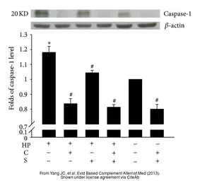 Anti-Caspase 1 antibody [N1N3] used in Western Blot (WB). GTX101322