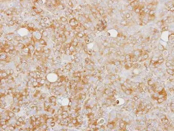 Anti-Caspase 1 antibody [N1N3] used in IHC (Paraffin sections) (IHC-P). GTX101322