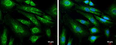 Anti-APP antibody [C2C3], C-term used in Immunocytochemistry/ Immunofluorescence (ICC/IF). GTX101336