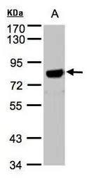 Anti-APP antibody [C2C3], C-term used in Western Blot (WB). GTX101336