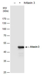 Anti-Ataxin 3 antibody used in Western Blot (WB). GTX101343