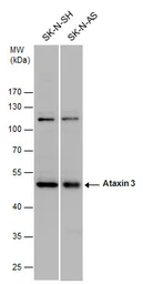 Anti-Ataxin 3 antibody used in Western Blot (WB). GTX101343