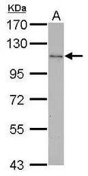 Anti-CBL antibody [C2C3], C-term used in Western Blot (WB). GTX101352