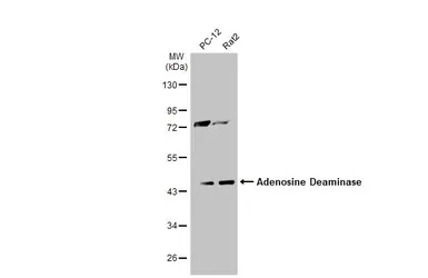 Anti-Adenosine Deaminase antibody used in Western Blot (WB). GTX101390