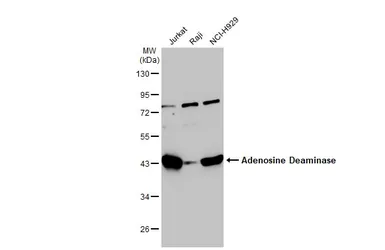 Anti-Adenosine Deaminase antibody used in Western Blot (WB). GTX101390