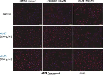 Anti-ACE2 antibody [N1N2], N-term used in Immunocytochemistry/ Immunofluorescence (ICC/IF). GTX101395