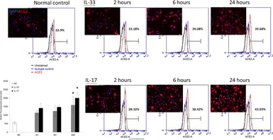 Anti-ACE2 antibody [N1N2], N-term used in Immunocytochemistry/ Immunofluorescence (ICC/IF). GTX101395