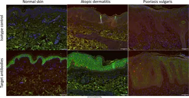 Anti-ACE2 antibody [N1N2], N-term used in IHC (Paraffin sections) (IHC-P). GTX101395