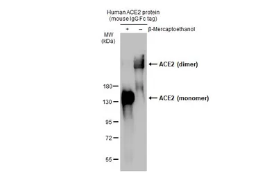 Anti-ACE2 antibody [N1N2], N-term used in Western Blot (WB). GTX101395