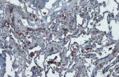 Anti-ACE2 antibody [N1N2], N-term used in IHC (Paraffin sections) (IHC-P). GTX101395