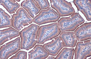 Anti-ACE2 antibody [N1N2], N-term used in IHC (Paraffin sections) (IHC-P). GTX101395