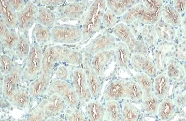 Anti-ACE2 antibody [N1N2], N-term used in IHC (Paraffin sections) (IHC-P). GTX101395