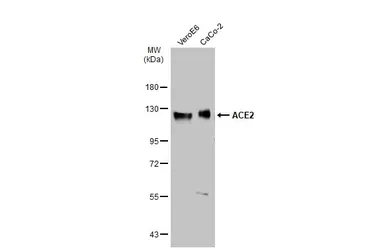 Anti-ACE2 antibody [N1N2], N-term used in Western Blot (WB). GTX101395