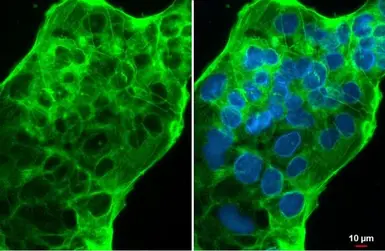 Anti-ACE2 antibody [N1N2], N-term used in Immunocytochemistry/ Immunofluorescence (ICC/IF). GTX101395