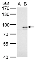 Anti-Alkyl-DHAP synthase antibody used in Western Blot (WB). GTX101396