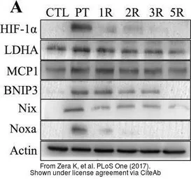 Anti-LDHA antibody used in Western Blot (WB). GTX101416