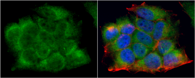 Anti-LDHA antibody used in Immunocytochemistry/ Immunofluorescence (ICC/IF). GTX101416