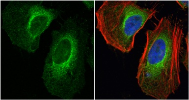 Anti-LDHA antibody used in Immunocytochemistry/ Immunofluorescence (ICC/IF). GTX101416