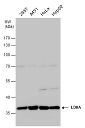 Anti-LDHA antibody used in Western Blot (WB). GTX101416