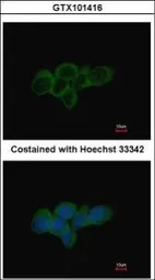 Anti-LDHA antibody used in Immunocytochemistry/ Immunofluorescence (ICC/IF). GTX101416