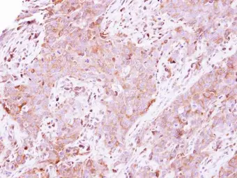 Anti-LDHA antibody used in IHC (Paraffin sections) (IHC-P). GTX101416