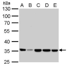 Anti-LDHA antibody used in Western Blot (WB). GTX101416