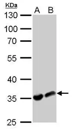 Anti-LDHA antibody used in Western Blot (WB). GTX101416