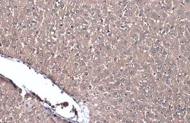 Anti-LDHA antibody used in IHC (Paraffin sections) (IHC-P). GTX101416