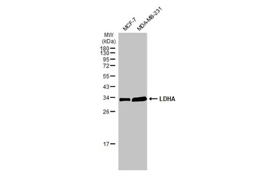 Anti-LDHA antibody used in Western Blot (WB). GTX101416