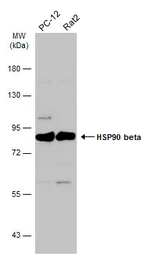 Anti-Hsp90 beta antibody [N2C2], Internal used in Western Blot (WB). GTX101423