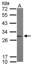 Anti-Rho GDI alpha antibody [N1C3] used in Western Blot (WB). GTX101428