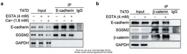 Anti-beta Catenin antibody [N1N2-2], N-term used in Western Blot and Immunoprecipitation (WB IP). GTX101435