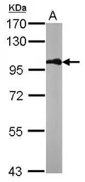 Anti-beta Catenin antibody [N1N2-2], N-term used in Western Blot (WB). GTX101435