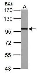 Anti-beta Catenin antibody [N1N2-2], N-term used in Western Blot (WB). GTX101435