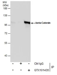 Anti-beta Catenin antibody [N1N2-2], N-term used in Immunoprecipitation (IP). GTX101435