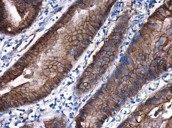 Anti-beta Catenin antibody [N1N2-2], N-term used in IHC (Paraffin sections) (IHC-P). GTX101435