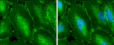 Anti-beta Catenin antibody [N1N2-2], N-term used in Immunocytochemistry/ Immunofluorescence (ICC/IF). GTX101435