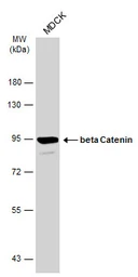 Anti-beta Catenin antibody [N1N2-2], N-term used in Western Blot (WB). GTX101435